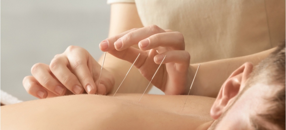 Does dry needling help inflammation?
