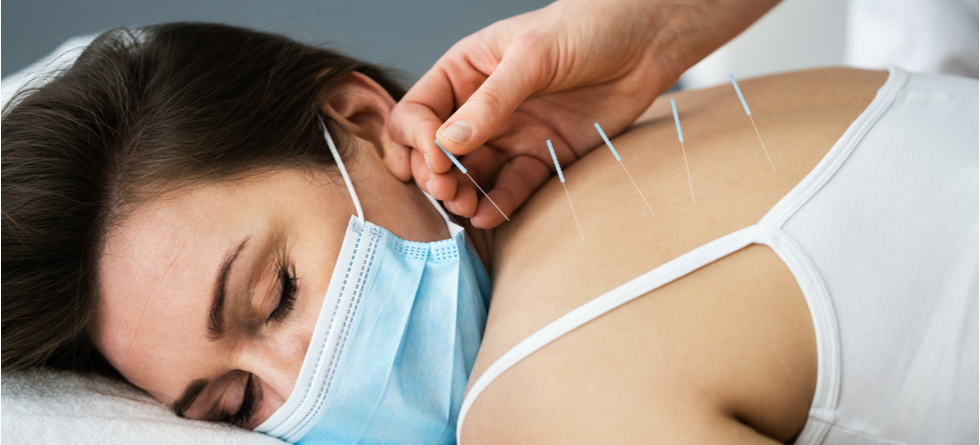 How long is a needling session?