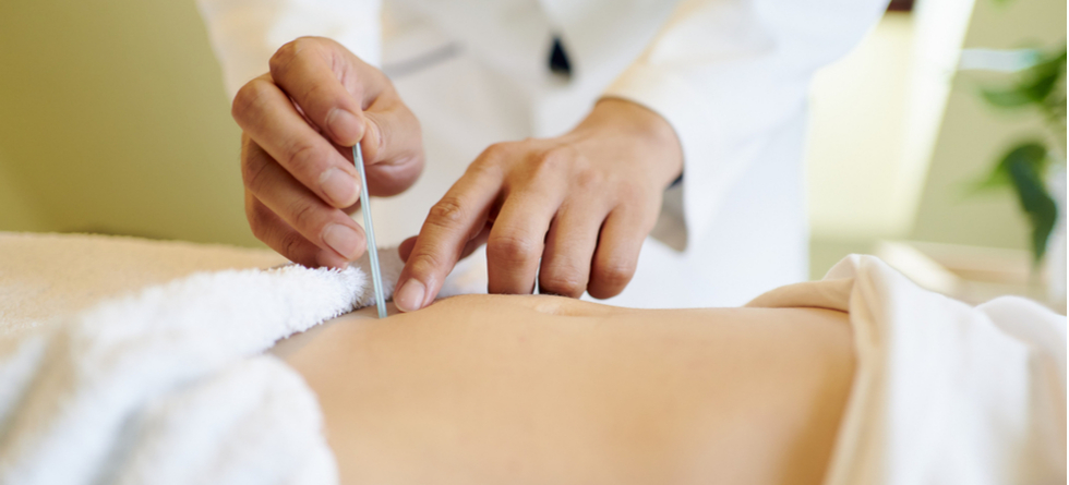 How painful is dry needling?