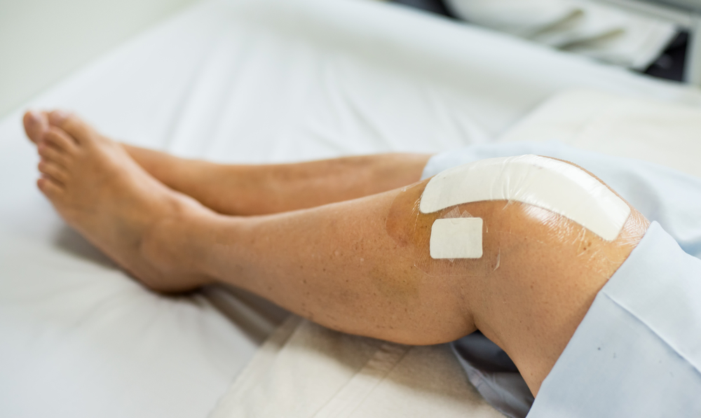How Common Is Joint Replacement Surgery?