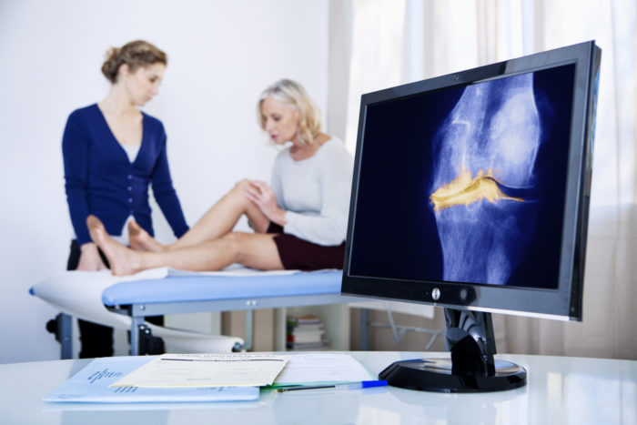 What Is The Best Age To Have A Knee Replacement?