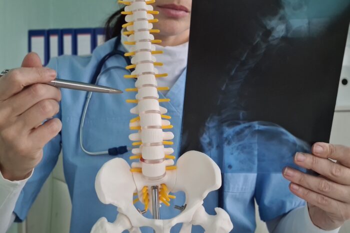 What Is The Most Painful Lower Back Condition?