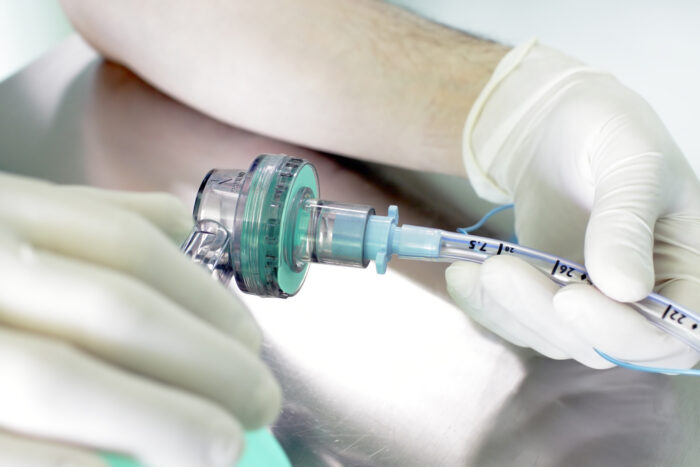 Do They Put A Tube Down Your Throat For Rotator Cuff Surgery?